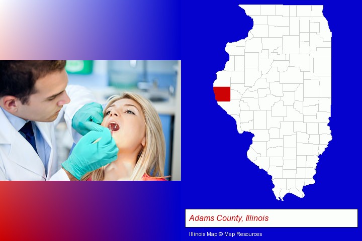 a dentist examining teeth; Adams County, Illinois highlighted in red on a map