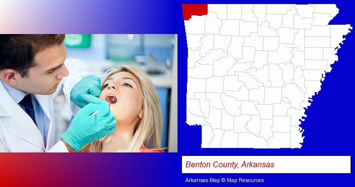 a dentist examining teeth; Benton County, Arkansas highlighted in red on a map