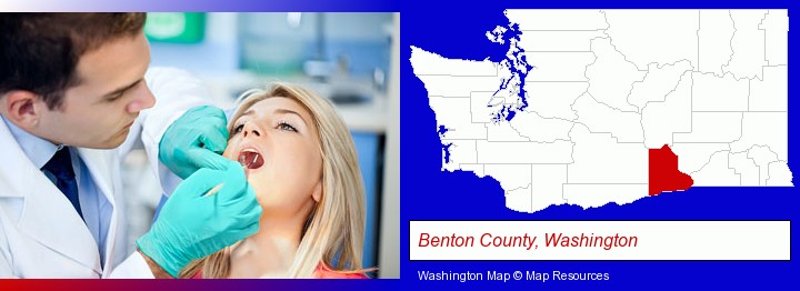 a dentist examining teeth; Benton County, Washington highlighted in red on a map