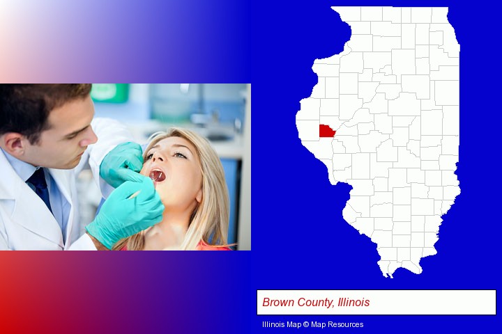 a dentist examining teeth; Brown County, Illinois highlighted in red on a map