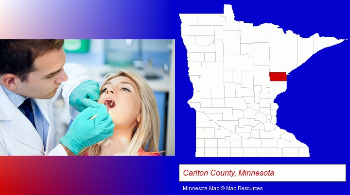a dentist examining teeth; Carlton County, Minnesota highlighted in red on a map