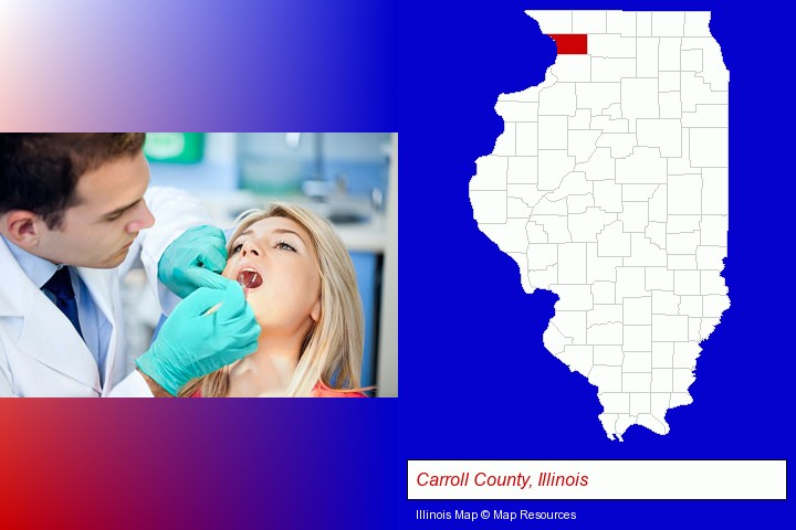 a dentist examining teeth; Carroll County, Illinois highlighted in red on a map