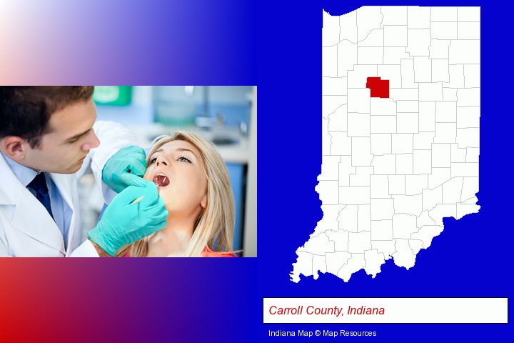 a dentist examining teeth; Carroll County, Indiana highlighted in red on a map