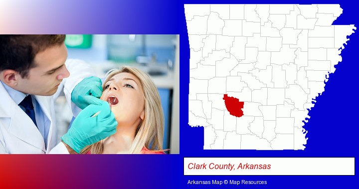 a dentist examining teeth; Clark County, Arkansas highlighted in red on a map