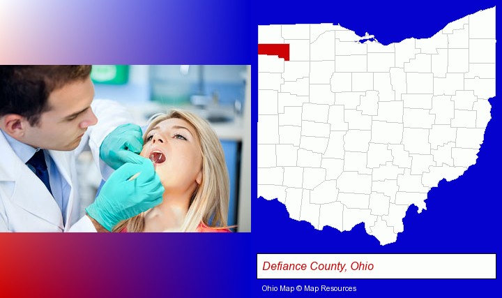 a dentist examining teeth; Defiance County, Ohio highlighted in red on a map