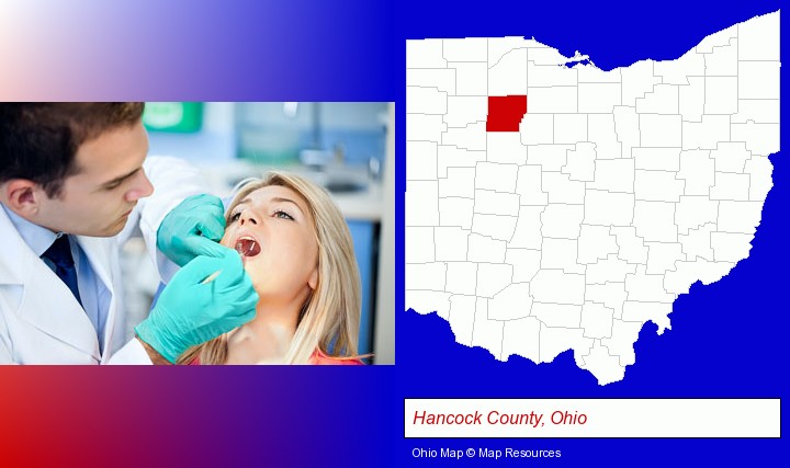 a dentist examining teeth; Hancock County, Ohio highlighted in red on a map