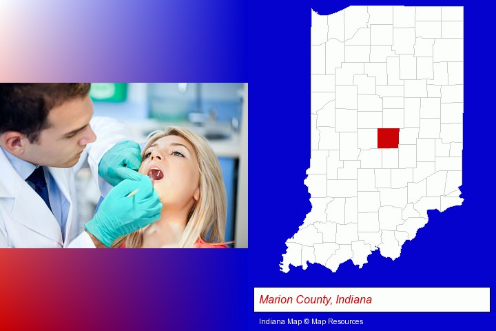 a dentist examining teeth; Marion County, Indiana highlighted in red on a map