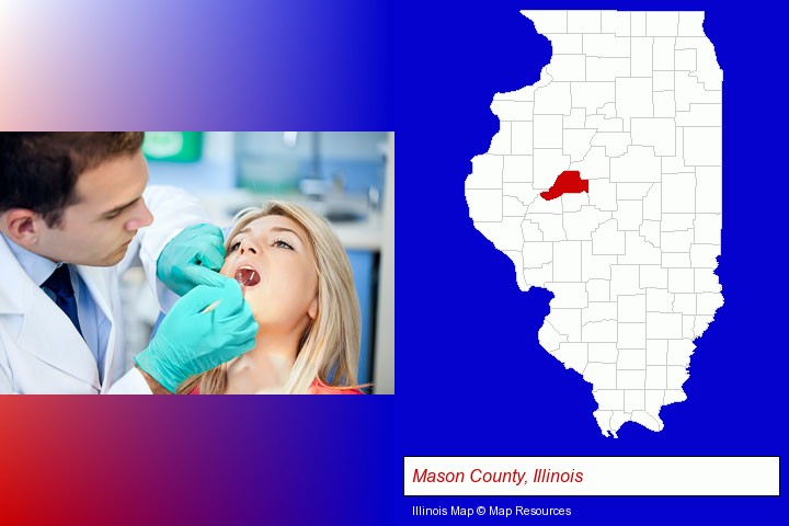 a dentist examining teeth; Mason County, Illinois highlighted in red on a map