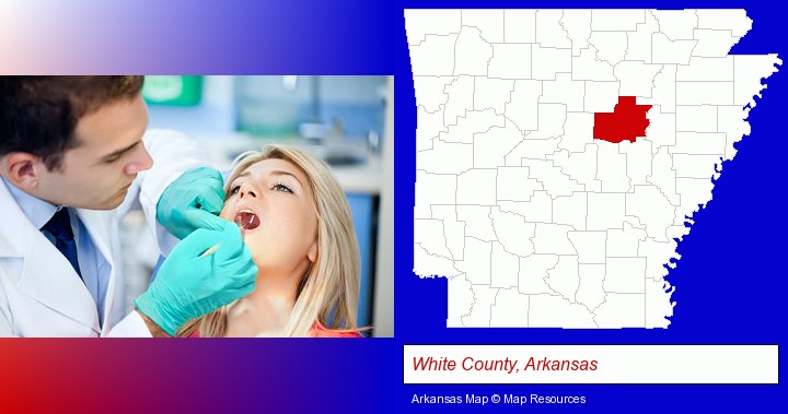 a dentist examining teeth; White County, Arkansas highlighted in red on a map